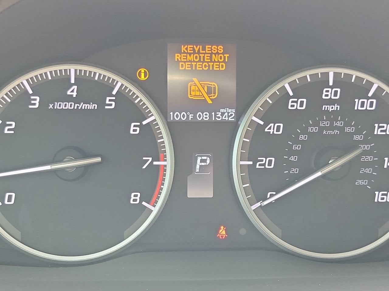 2017 Acura RDX Technology Package